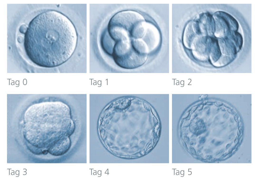 Abbildung der Embryonalentwicklung im Kultur-Medium vom Zeitpunkt der Befruchtung bis zum Blastozystenstadium │ © 2021 Next Fertility IVF Prof. Zech
