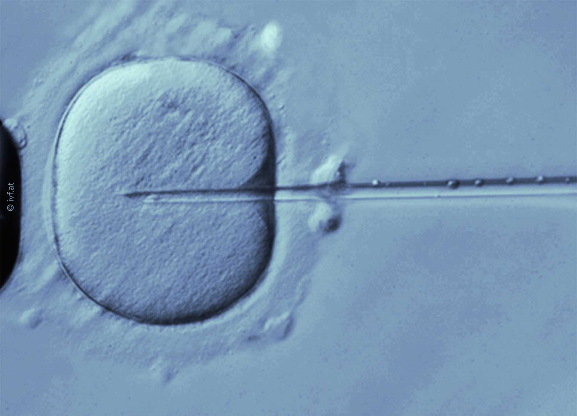 Mikroskopie einer ICSI, © Next Fertility IVF Prof. Zech Bregenz