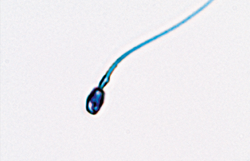 DNA-Fragmentierung │ © 2024 Next Fertility IVF Prof. Zech