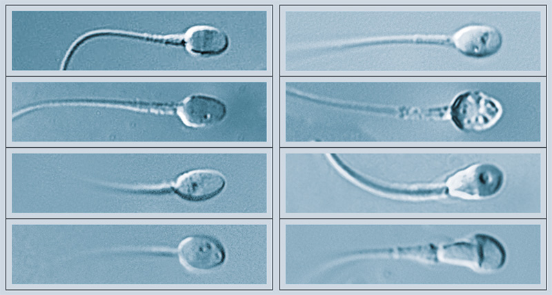 Morphologie-Detailanalyse │ © 2024 Next Fertility IVF Prof. Zech